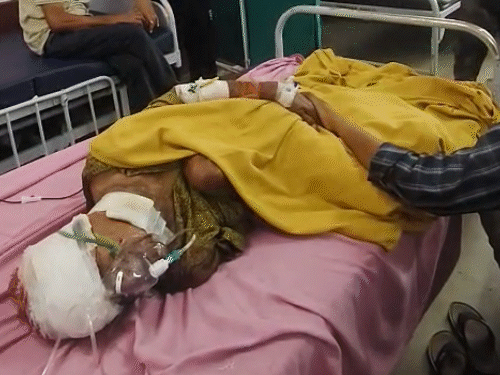महिला के सिर और गर्दन में लेपर्ड के दांत घुस गए। घायल महिला को जिला हॉस्पिटल में भर्ती करवाया गया।