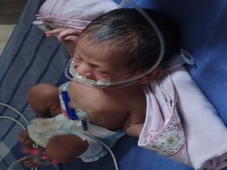 बच्चे का अस्पताल में इलाज चल रहा है।