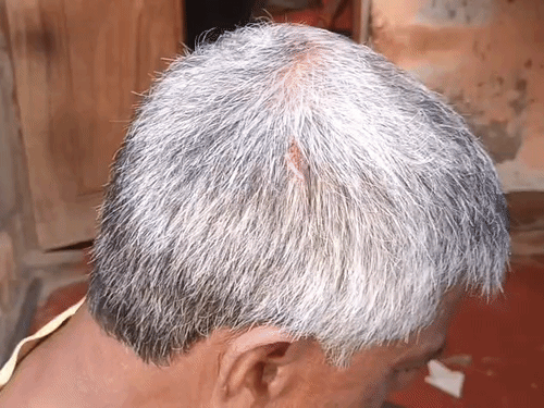 वारदात के दौरान पड़ोसी पान दुकानदार अशोक पासी उर्फ बाबा को भी सिर में गंभीर चोटें आईं।