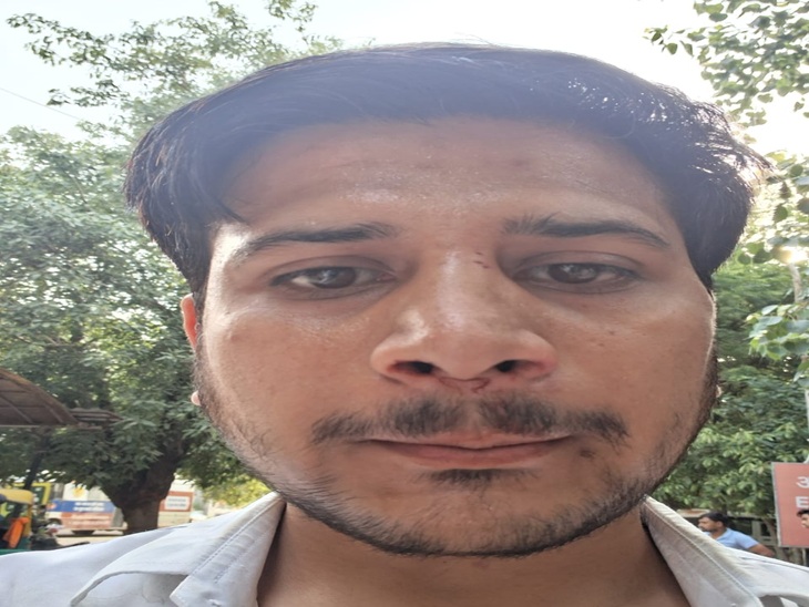 फरीदाबाद के एडवोकेट तुषार के साथ थाने में मारपीट के मामले में FIR दर्ज कर ली गई है। - Dainik Bhaskar