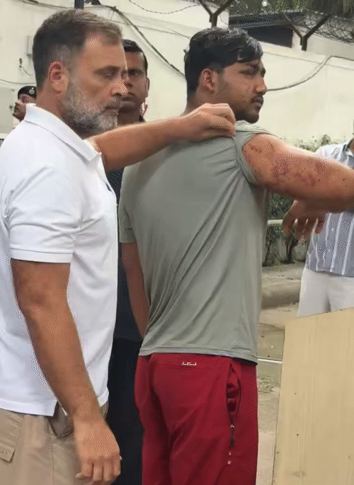 राहुल गांधी ने 24 जुलाई को जंतर-मंतर प्रदर्शन में घायल स्टूडेंट के घाव दिखाए थे। कहा था कि छात्र पैलेट गन से घायल हुआ।