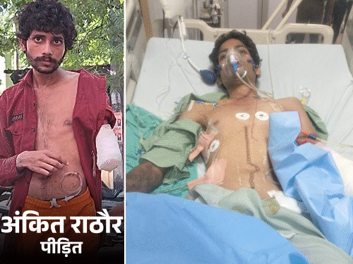 लखनऊ में मां का दर्द- डॉक्टर की लापरवाही से बेटे की जिंदगी बर्बाद|उत्तरप्रदेश,Uttar Pradesh - Dainik Bhaskar