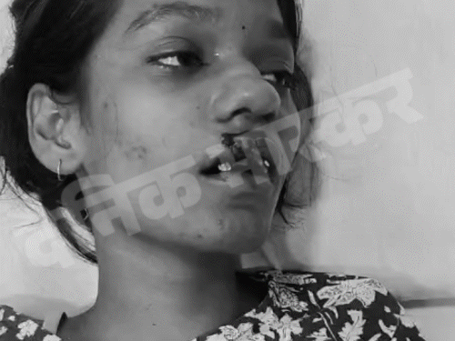 इंदिरानगर सावन महोत्सव की घटना, कहने के बावजूद ऑपरेटर ने नहीं रोका|लखनऊ,Lucknow - Dainik Bhaskar