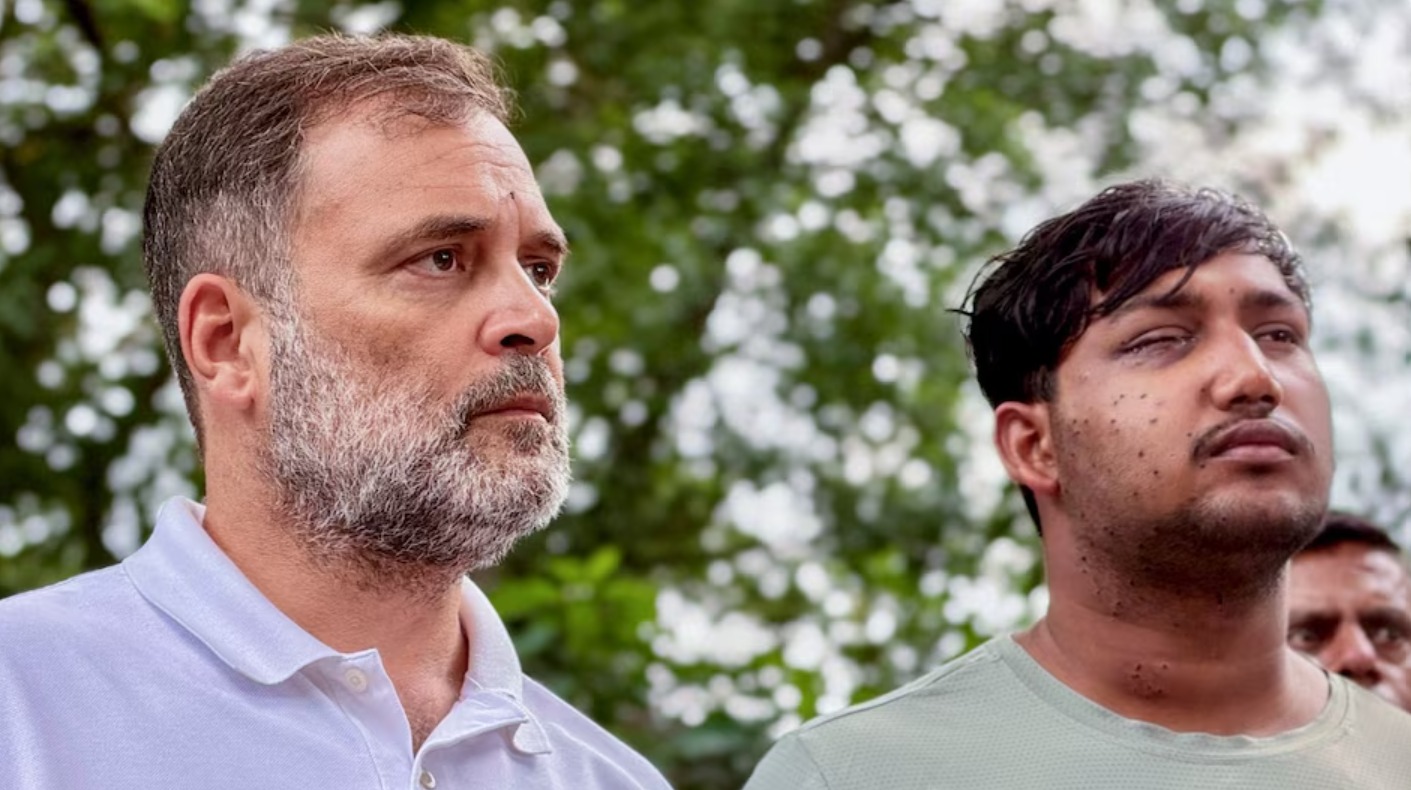 राहुल गांधी के साथ साहिल लोहचब। साहिब की दाईं आंख की रोशनी चली गई है। उसके चेहरे पर काफी निशान हैं। (फोटो सोर्स PTI)