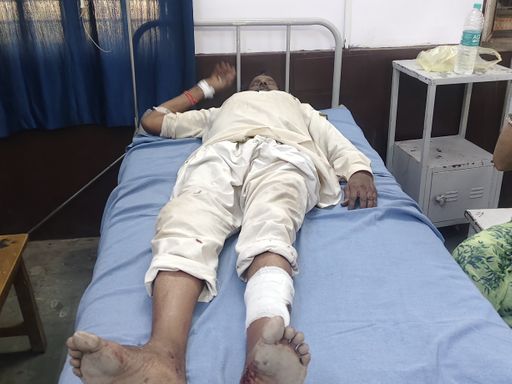 टोडरा उपतहसील क्षेत्र में ड्यूटी पर तैनात सिक्योरिटी गार्ड पर लेपर्ड ने हमला कर दिया था।