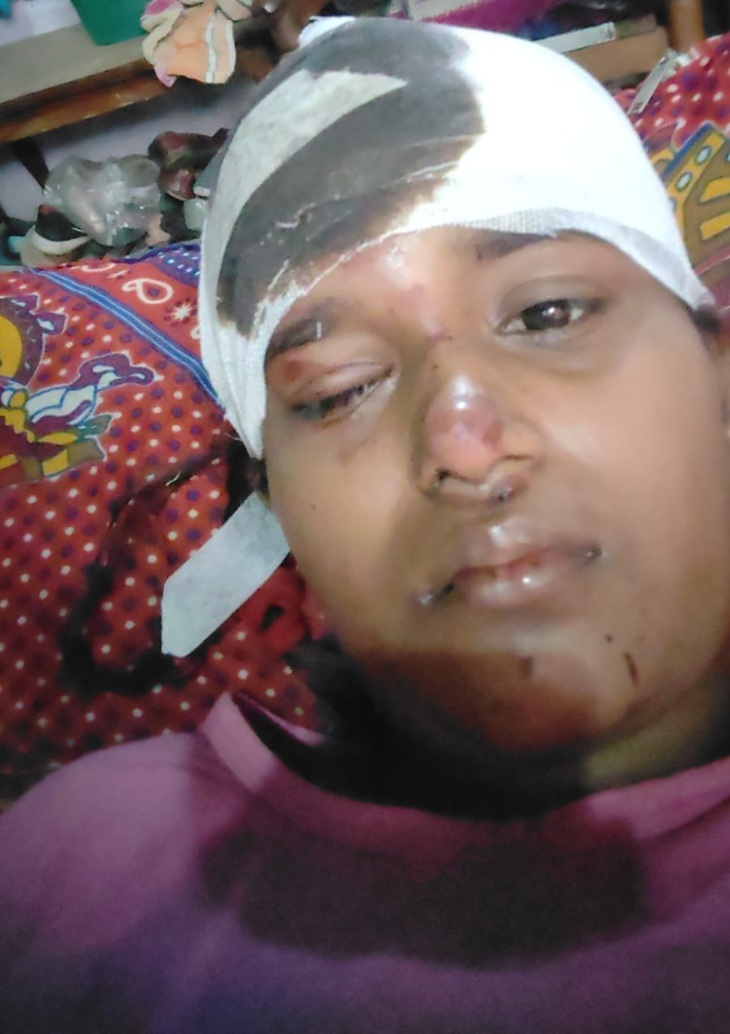 Khushi received 18 stitches on her head. In addition, she has several scratches on her face.