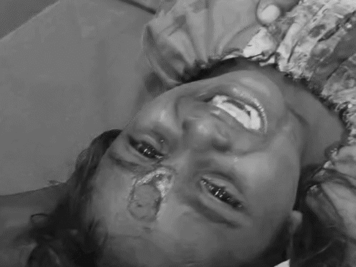 ये है 3 साल की केला, बच्ची के माथे पर कुत्ते ने हमला किया। उसकी चमड़ी ही उधड़ गई।