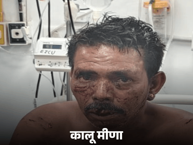 घायल कालू, जग्गा और हितेश।