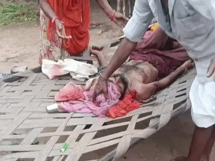 लेपर्ड के हमले से घायक एक व्यक्ति।