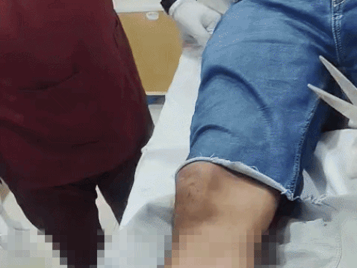 सोसायटी में किरायेदारों का सत्यापन पड़ा भारी, आरडब्ल्यूए प्रधान पर हमला - Dainik Bhaskar