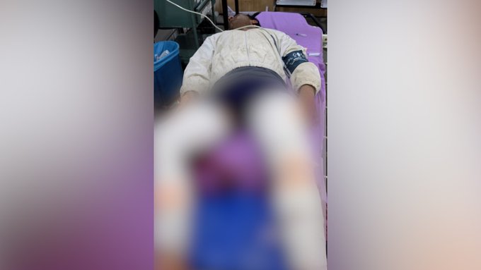एनकाउंटर के बाद अस्पताल में भर्ती आरोपी इमरान।