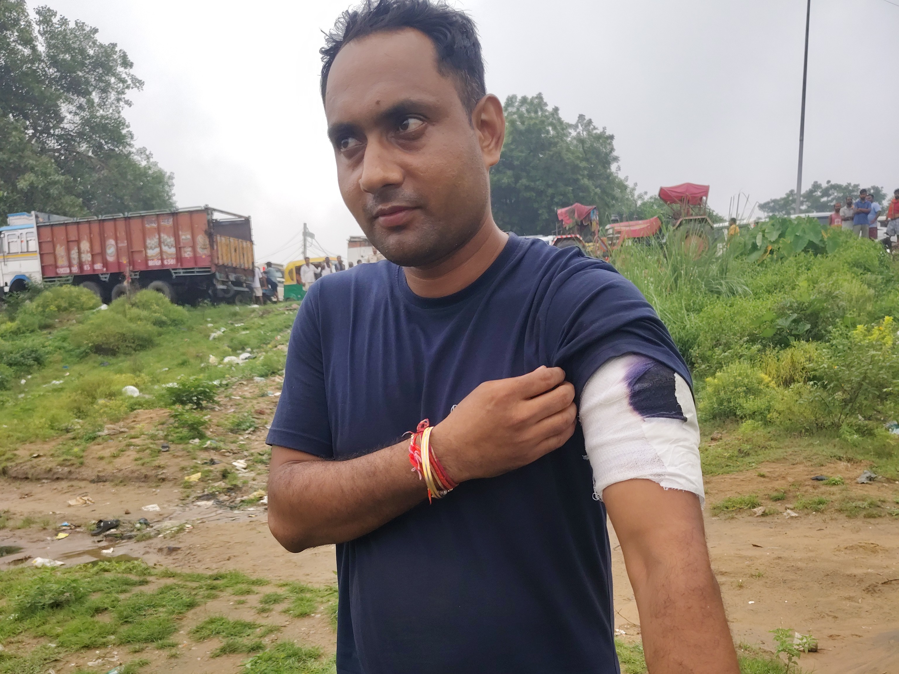 एनकाउंटर में इंस्पेक्टर राजू सिंह के बांह में गोली लगी है।