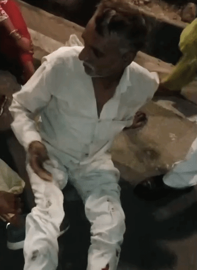 पुलिस कार्रवाई में घायल हुआ सफाई कर्मचारी।