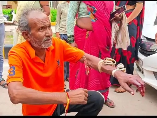 कोबरा का रेस्क्यू करते समय सांप ने सपेरे को डस लिया।