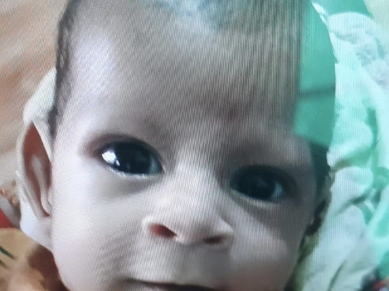 मां की गोद से उछलकर सिर के बल गिरा, माता-पिता बुखार में अस्पताल ले जा रहे थे|लखनऊ,Lucknow - Dainik Bhaskar