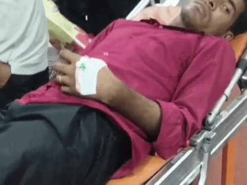 CCSU में छात्र को सांप ने काटा, मेडिकल में भर्ती