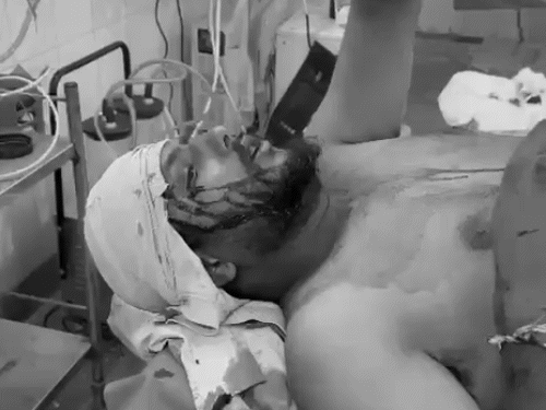 अलवर में वोटिंग से पहले निर्दलीय कैंडिडेट अजय मीरवाल के समर्थकों के साथ मारपीट की गई। मारपीट का आरोप बीजेपी प्रत्याशी जगदीश अटल और उनके बेटों पर लगाया है।