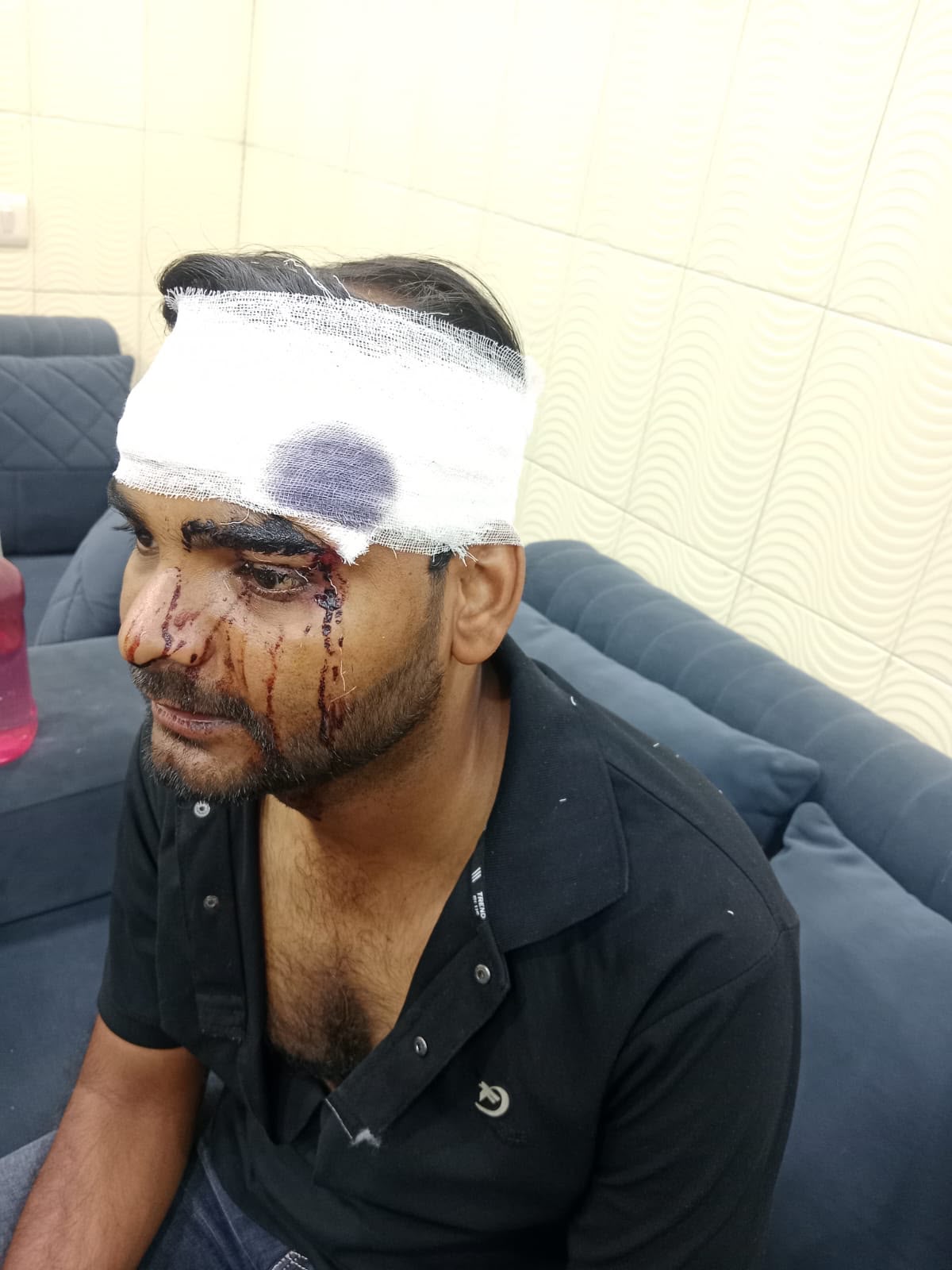 सिर पर चोट लगी दिखांते हुए पीड़ित सोनू