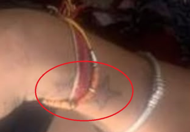 महिला की बाजू पर बने 3 स्टार का टैटू।