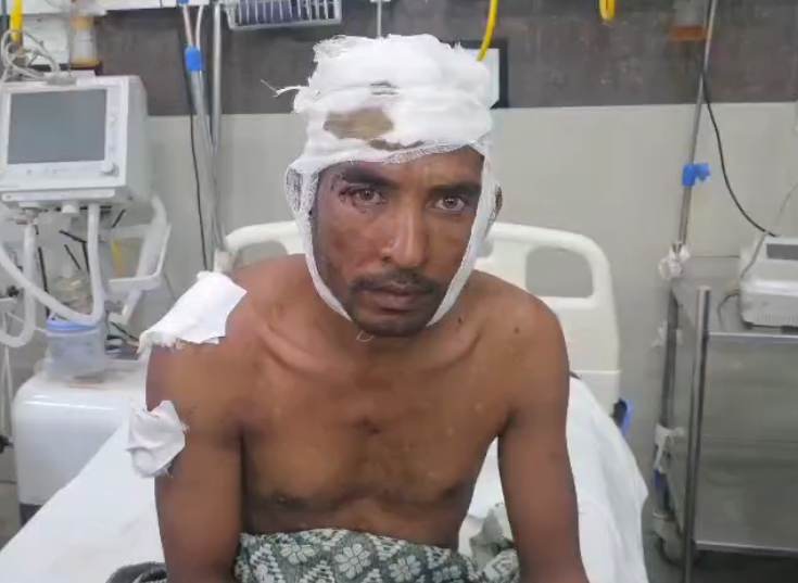 घायल के सिर पर गंभीर चोट आई है। सिम्स में इलाज जारी है।
