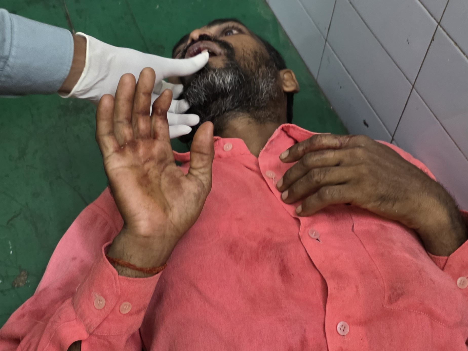 Ayodhya Bikapur Accident | Bike Rider Critically Injured in Kisanganj
