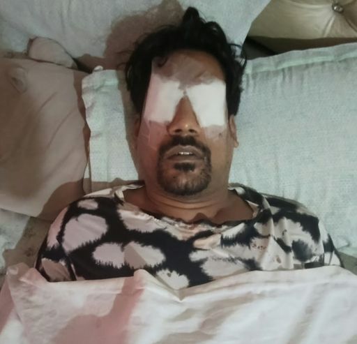 महिला सचिव के बेटे को आंखों में कांच के टुकड़े लगने का दावा किया गया है।