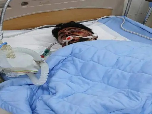 जमशेदपुर के 25 वर्षीय विनय कुमार राय भी हादसे में घायल हुए हैं।