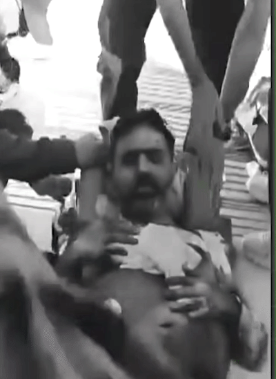 ओमानी पायलट के हमले में घायल कैप्टन स्मित मच्छर। 30 सितंबर को सऊदी में लैंड होने के बाद उन्हें इलाज के लिए ले जाया गया।