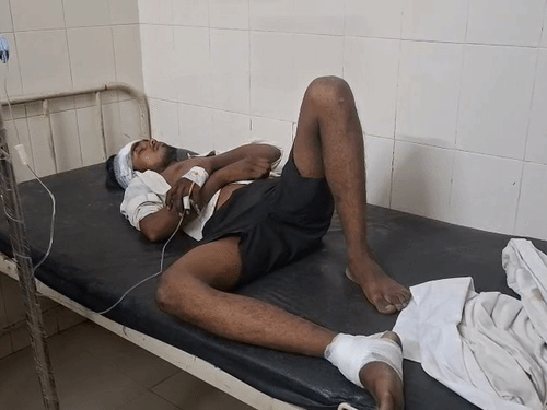हादसे में बाइक सवार को गंभीर चोटें आई हैं।