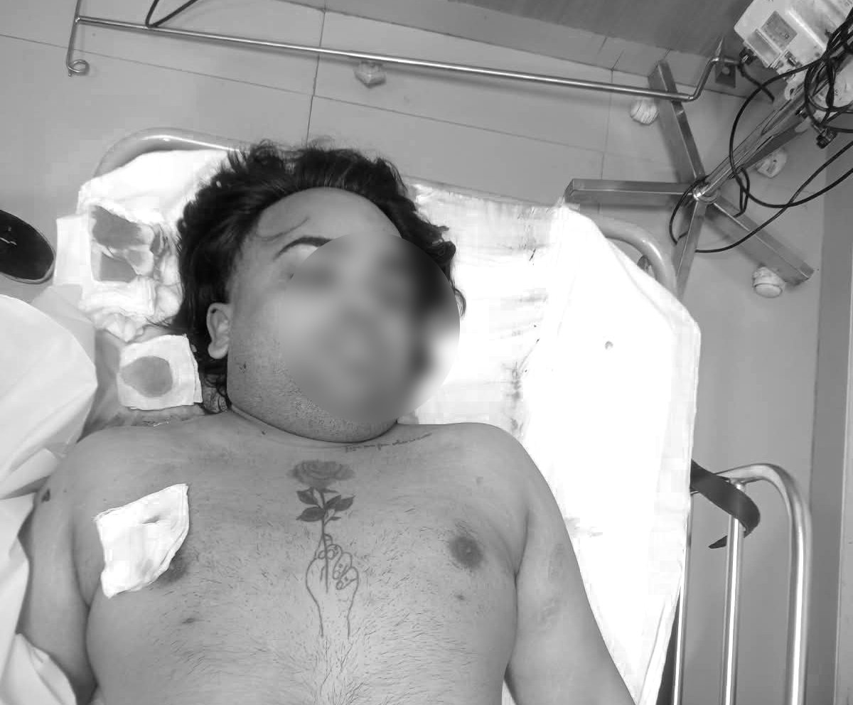 हमलावरों ने मैड संधू के सीने में गोली मारी।