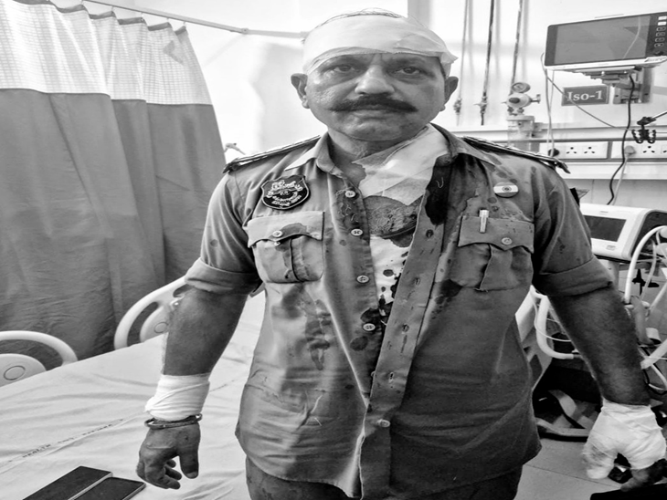 हमले में थाना प्रभारी की गर्दन पर पांच टांके आए, कलाई और अंगूठे पर भी चोट।