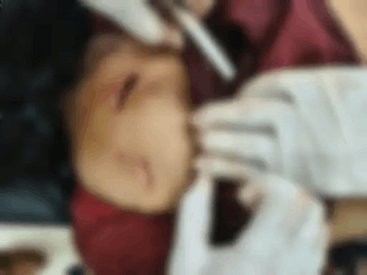 चाकू से हमले में युवती के पीठ, कमर, हाथ और सिर में गंभीर चोटें आई थीं।