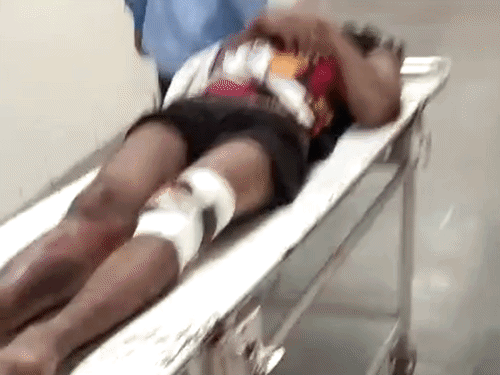 नागरिक अस्पताल में घायल बदमाश को इलाज के लिए ले जाते हुए स्वास्थ्य विभाग कर्मी।