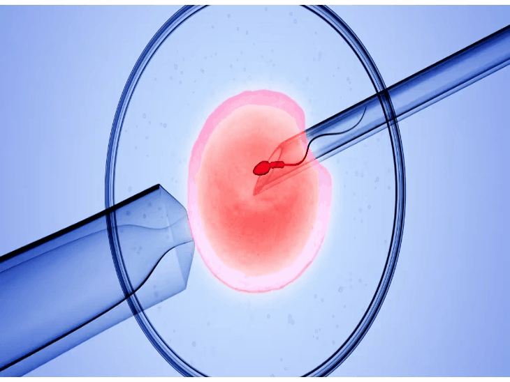 हाईकोर्ट ने 47 साल की पत्नी को IVF की मंजूरी दी; सरोगेसी बोर्ड ने रोका था इलाज|बिलासपुर (छत्तीसगढ़),Bilaspur (Chhattisgarh) - Dainik Bhaskar