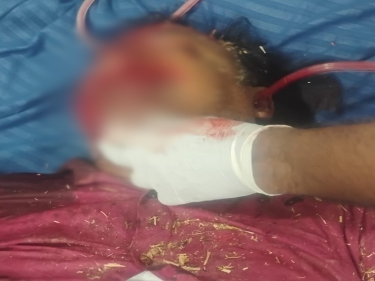 हादसे में घायल शख्स को इलाज के लिए अस्पताल में भर्ती किया गया है।