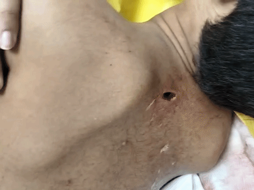 बेटे मलिक साहिब की पीठ पर चाकू से आरोपी ने अटैक किया।