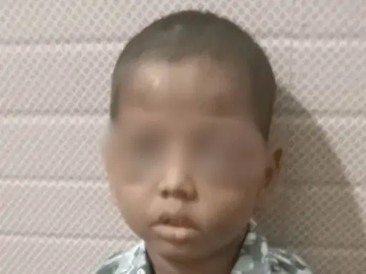 बच्चे की आंख चोट के कारण बुरी तरह सूज गई है।