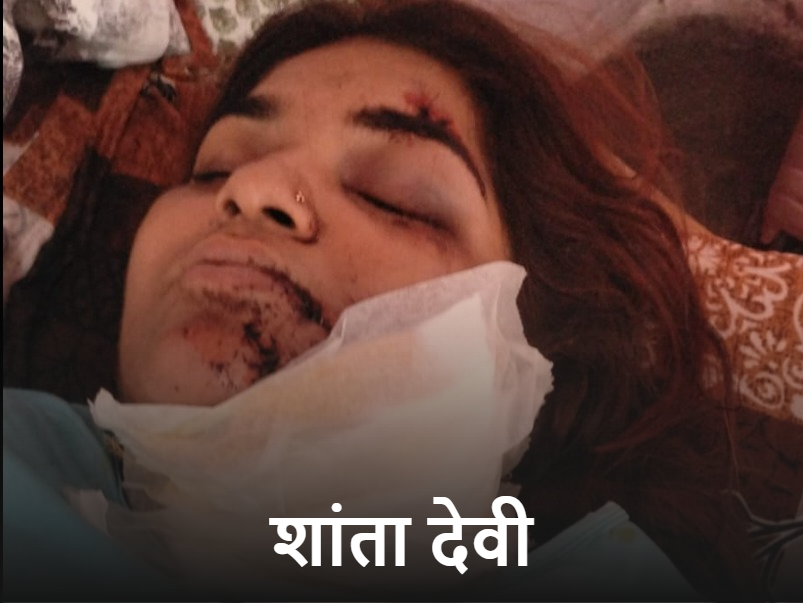 घायल महिला शांता देवी।