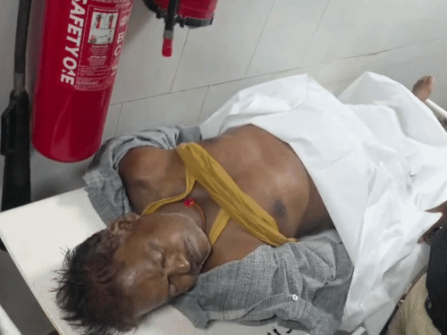 सिम्स में इलाज के दौरान बसपा पार्षद रामखिलावन जांगड़े की मौत हो गई।