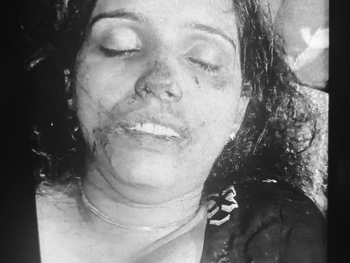 मनीषा के छाती में चाकू मारा गया था। जब पुलिस मौके पर पहुंची तो उसके चेहरे पर भी खून लगा हुआ था।