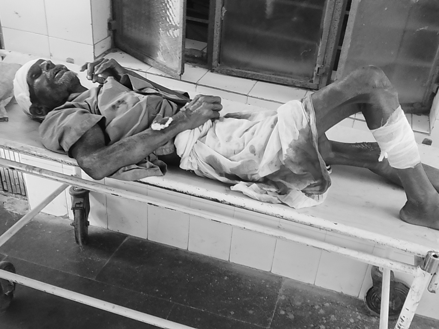 Ricksshaw Narhat E-Rickshaw Accident | Hemraj Yadav Injured, Referred To Nawada