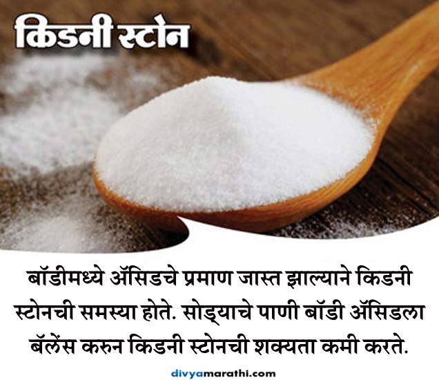 10 Benefits Of Baking Soda उपाशीपोटी पाण्यात बेकिंग सोडा मिसळून