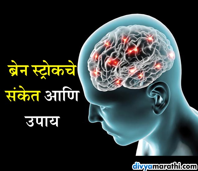 क्षुल्लक गोष्ट समजून चुकूनही दुर्लक्ष करू नका ब्रेन स्ट्रोकच्या या