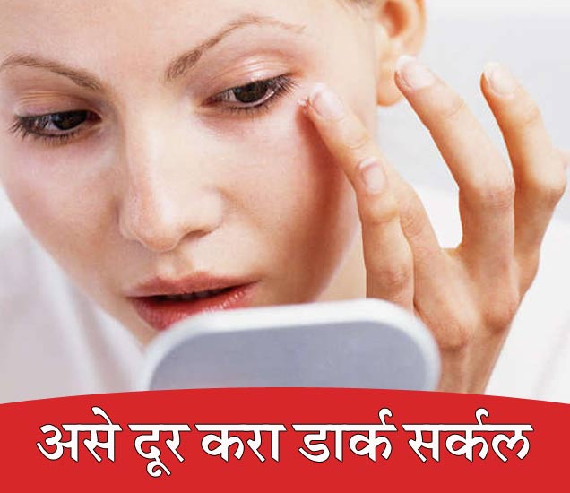 Treatments for Dark Circles तुम्हालाही डार्क सर्कल झाले आहेत का? या