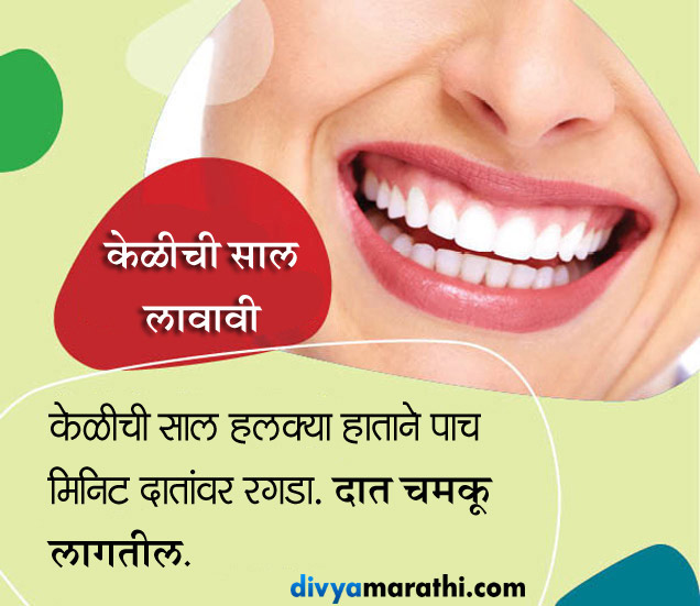 दातांचा पिवळेपणा दूर करा स्वस्तात, हे घरगुती उपाय करतील मदत yellow