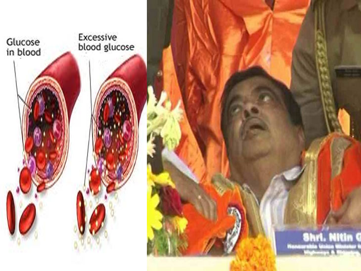 नितीन गडकरी यांना लो ब्लड शुगरमुळे अचानक आली भोवळ, जाणून घ्या याचा