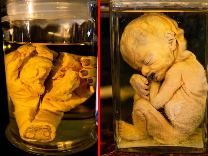 Man Sells Pickled Human Body Parts & Weird, Scary Items, Inside SCARY