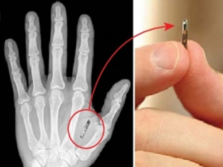 Companies were going to put chips in the hands of employees so that gates should not be opened