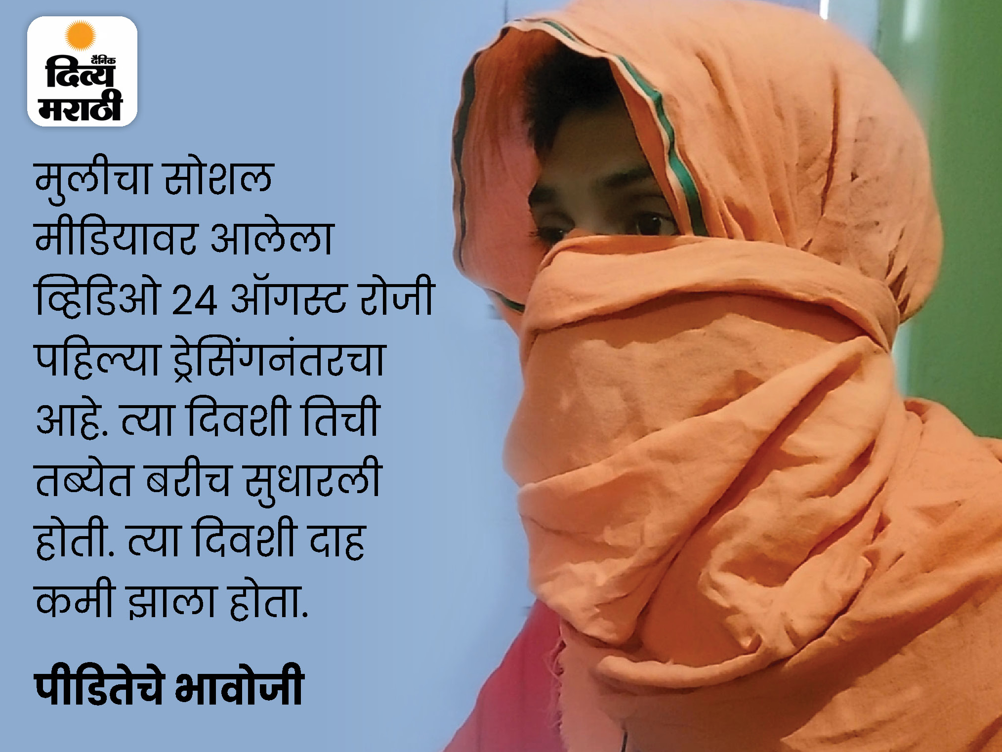 There was no AC in the burn ward, no ointment; First dressing after 28