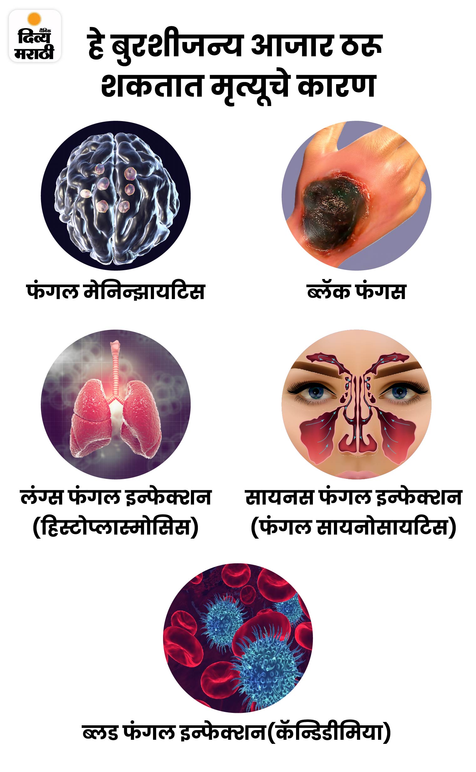 fungal infection symptoms treatment explained Health News बुरशी